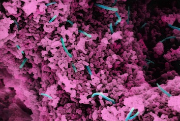 Microscopic image of a young plaque sample from a human mouth. Source Listerine -thumb-2775x1870-1051.jpg
